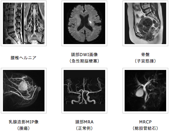 MRI検査3
