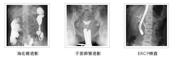 造影検査